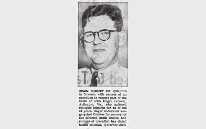 John Unger NIH brain surgery epilepsy