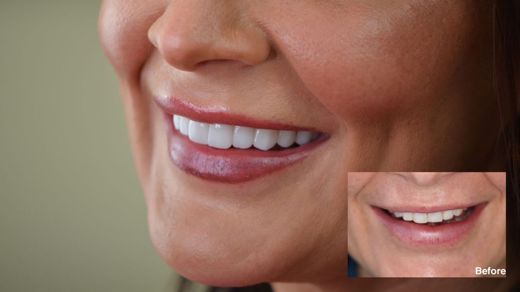 Siranli Implants & Facial Aesthetics & Prosthodontics
