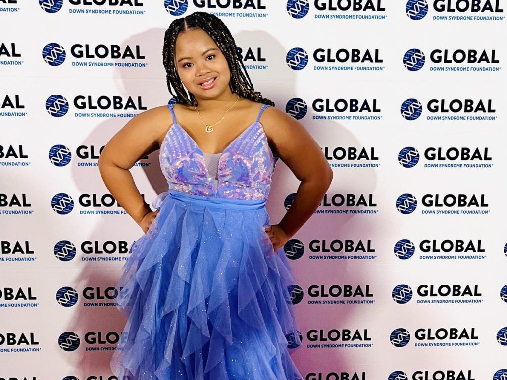 Meet the Arlington Teen Modeling for Down Syndrome Research
